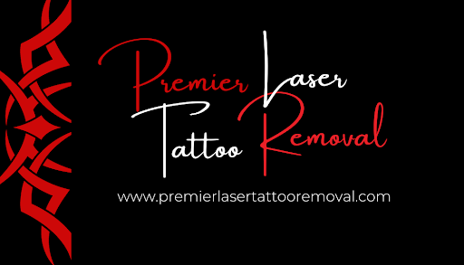 Explore tanning tattoo ideas, creative tattoo ideas in Tomball, available at Premier Laser Tattoo Removal