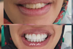 دندانپرشکی دکتر چاوش image