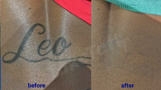 Explore prostate cancer tattoo ideas, creative tattoo ideas in Sheffield Lake, available at TakeTatt Tattoo Removal