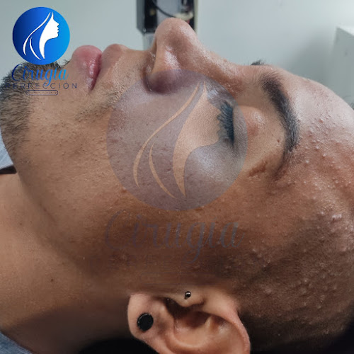 Cirugía Perfección