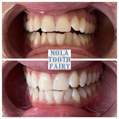 Nola Tooth Whitening