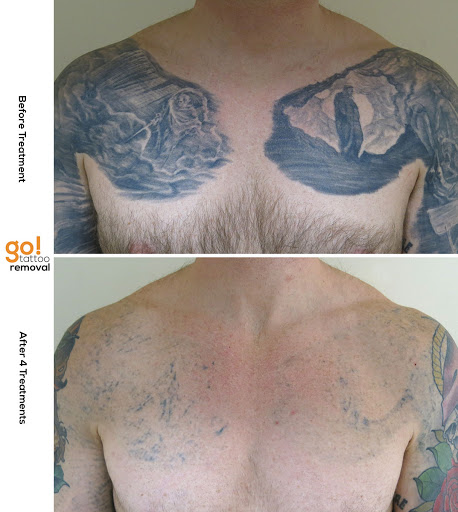 Explore nf tattoo ideas, creative tattoo ideas in Allentown, available at Removery Tattoo Removal & Fading