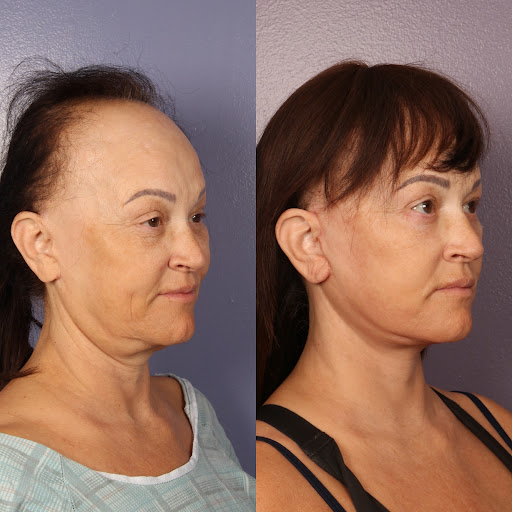 Dr. Gould Plastic Surgery image