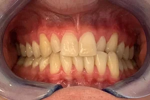 HQ dental image