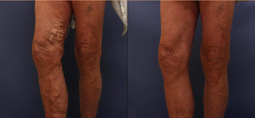 Beach Cities Vein and Laser Center image