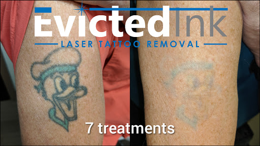 Explore dead inside tattoo ideas, creative tattoo ideas in Wichita, available at Evicted Ink Laser Tattoo Removal