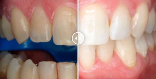 Clinica Dental Chafarinas en Adra, Almería