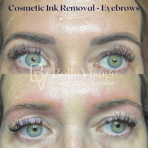 Explore empath tattoo ideas, creative tattoo ideas in Lakeland, available at Bella Visge Medical & Aesthetic Rejuvenation