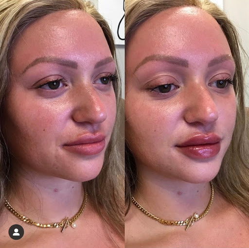 Explore left hand tattoo ideas, creative tattoo ideas in Canton, available at JDV Med Spa