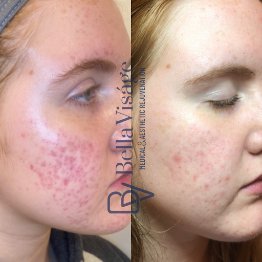 Find skull tattoo ideas for females for your next unique tattoo in Lakeland at Bella Visge Medical & Aesthetic Rejuvenation