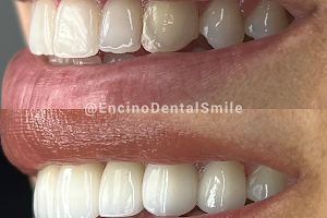 Encino Dental Smile image