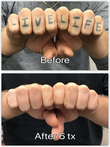 Explore state of michigan tattoo ideas, creative tattoo ideas in Honolulu, available at Removery Tattoo Removal & Fading
