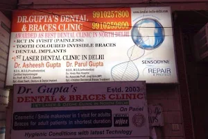 Dr. Gupta's Dental and Braces Clinic- Dentist in Delhi, Dental Implant, RCT Specialist, Dental Surgeon, Best Cosmetic Dentist image