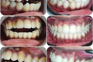 JJEDC ENDODONTIC Dental Implant Centre image