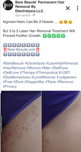 Explore marriage ring tattoo ideas, creative tattoo ideas in Des Moines, available at Bare Beaute Permanent Hair Removal By Electrolysis, LLC