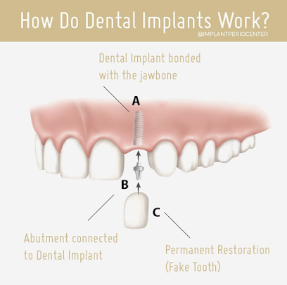 CENTER for Advanced Periodontal & Implant Therapy