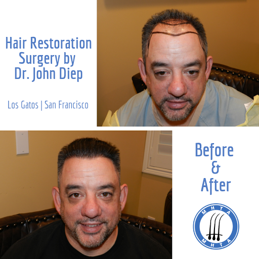 Hair Replacement Service «Medical Hair Transplants & Aesthetics», reviews and photos, 15055 Los Gatos Blvd Suite #110, Los Gatos, CA 95032, USA