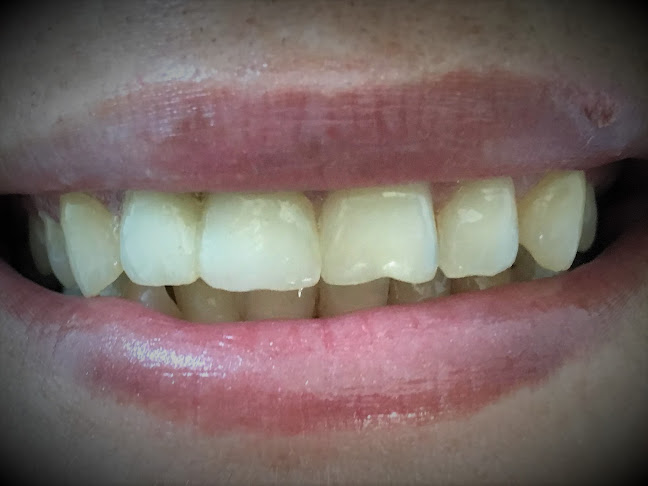 Opinii despre Cabinet Dentar Dr. Radu Sima 0723228817 în <nil> - Dentist