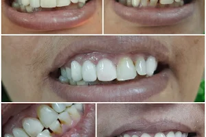 CARE - 32 DENTAL CLINIC AND IMPLANT CLINIC image