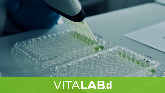 Teléfono de Vitalab, Laboratorio de Análisis y Diagnóstico Vegetal