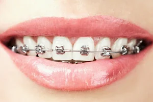 Vishnu dhanvanthri dental care & orthodontic clinic (Braces and aligners centre) image