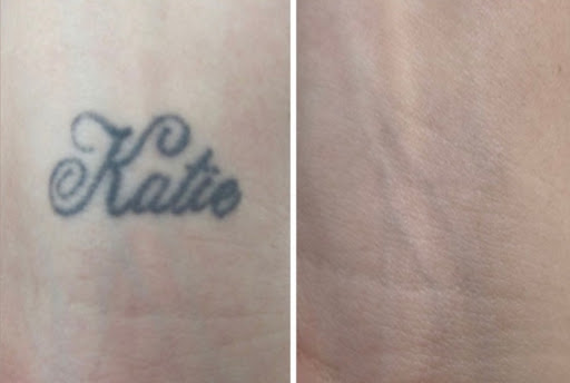 Explore script tattoo ideas female, creative tattoo ideas in Tucson, available at Allure Medical