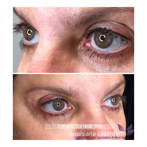 Explore banner tattoo ideas, creative tattoo ideas in Baton Rouge, available at Louisiana Laserderm