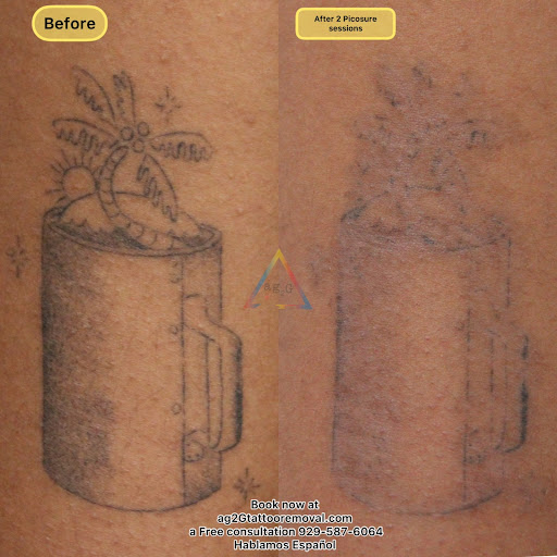 Explore pinup tattoo ideas, creative tattoo ideas in New York, available at Ag2g Laser Tattoo Removal & MedSpa