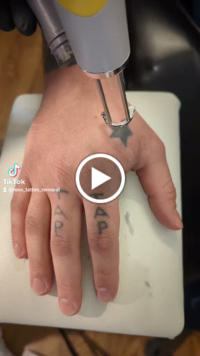 Explore tattoo ideas for back of shoulder, creative tattoo ideas in Reno, available at Reno Tattoo Removal