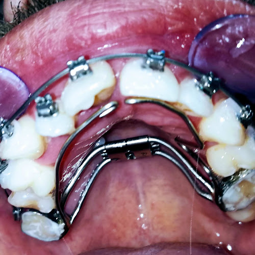 Vdent Clínica & Laboratorio Dental - Dentista