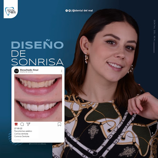 Dentista cosmético Zapopan