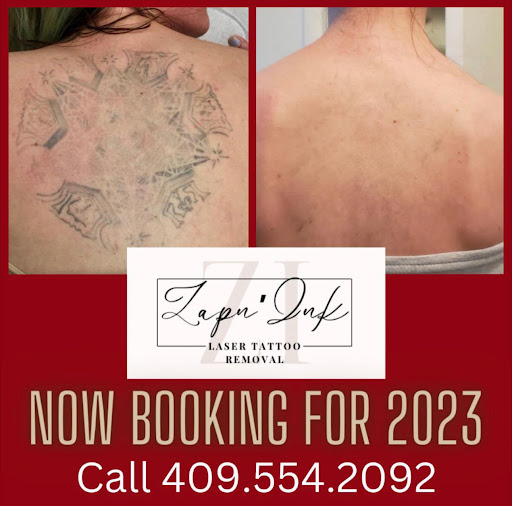Explore unity tattoo ideas, creative tattoo ideas in Beaumont, available at ZapnInk Laser Tattoo Removal