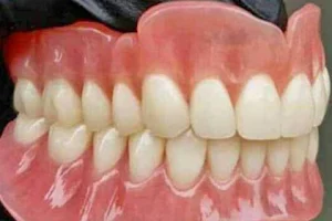 Tukang gigi palembang Yudha Jaya image
