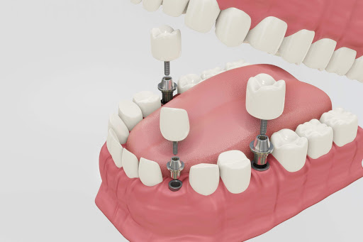 Clínica Dental Miguel Angel Giannasi en Guadalajara, Guadalajara