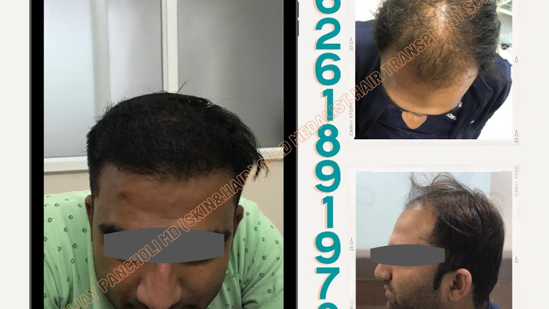 Dr sanjay pancholi skin and hair clinic