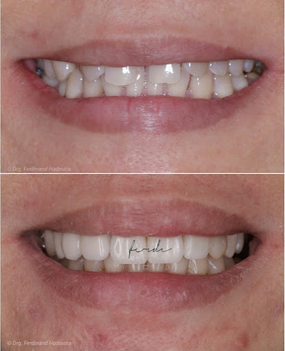 ابتسامة العناية بالأسنان سورابايا - Smile Dental Care Surabaya