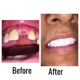 Pacific Dental Smiles - Cosmetic Dentist Ontario Ca
