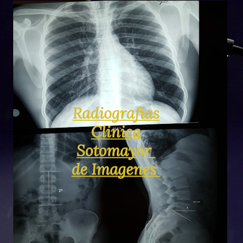 Comentarios y opiniones de CLINICA SOTOMAYOR DE IMAGENES Machala Radiografías Ecografías Mamografías Citas al (0984168555)(07-2933934)