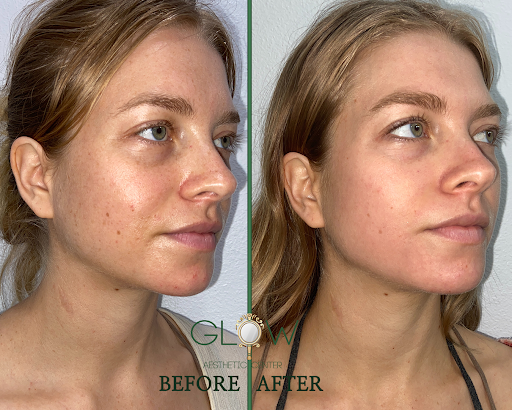 Glow Aesthetic Center Encino image