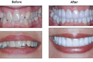 Pearls Dental Clinic & Implant Center image
