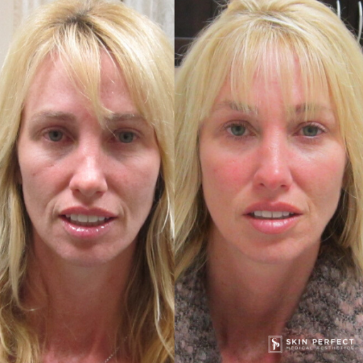 Explore big sister little sister tattoo ideas, creative tattoo ideas in Whittier, available at Skin Perfect Medical Aesthetics