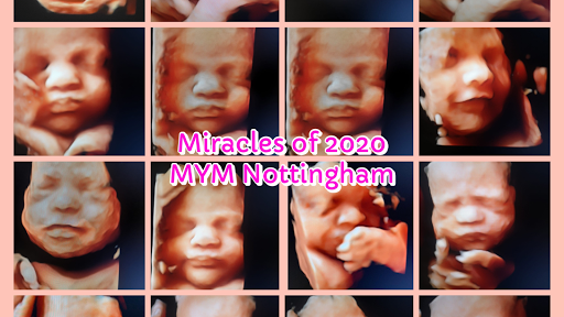 Meet Your Miracle Ultrasound Studio Nottingham