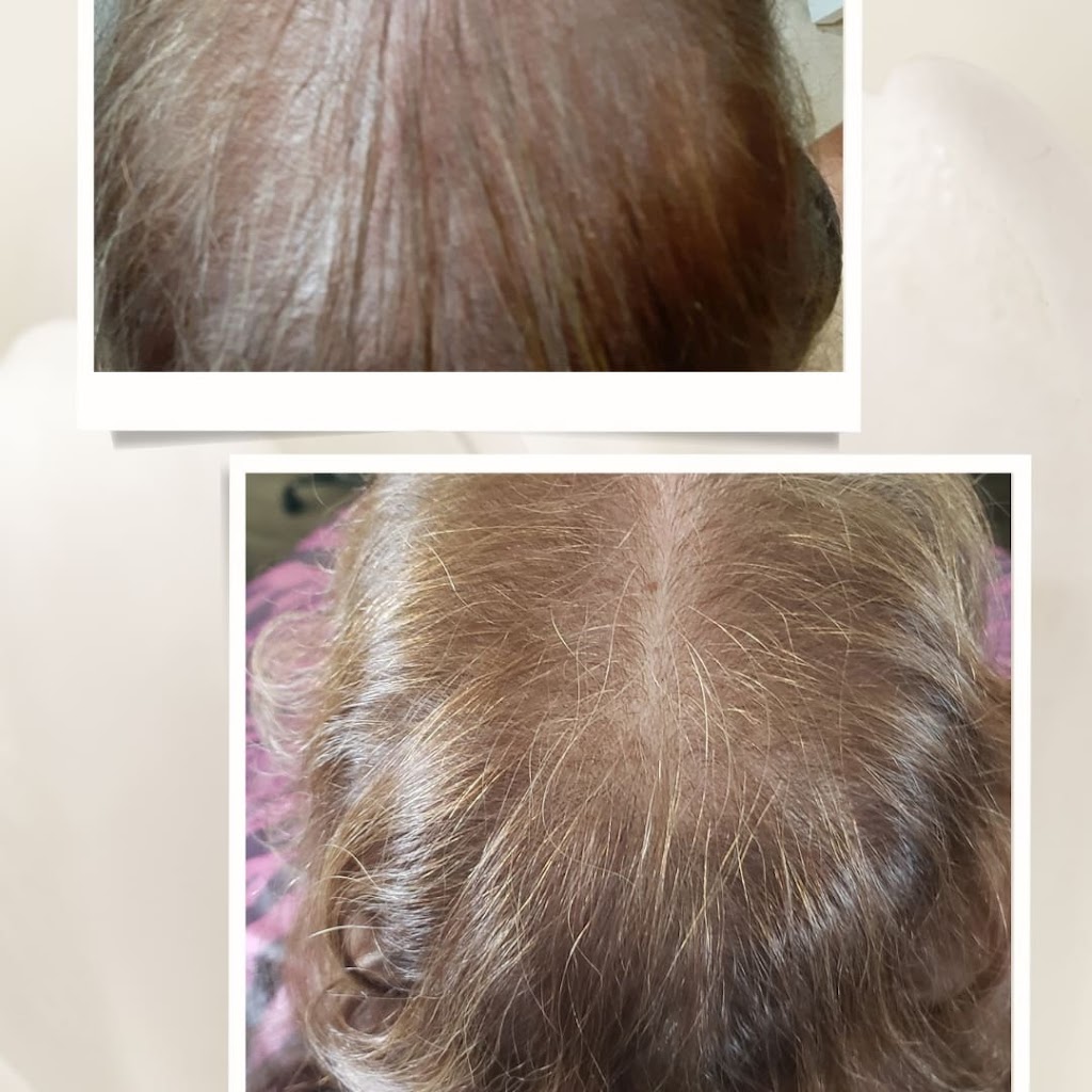 Hair Rejuvenation Center 47715