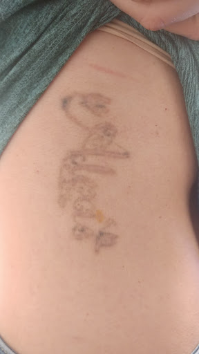 Explore flower name tattoo ideas, creative tattoo ideas in Fort Myers, available at Miss Cassies laser tattoo removal