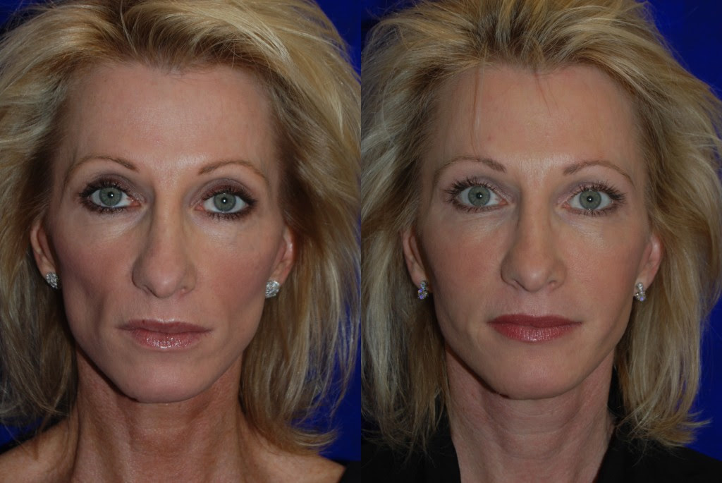 Westchester Aesthetic Center: Dr. Laurence Miller 10502