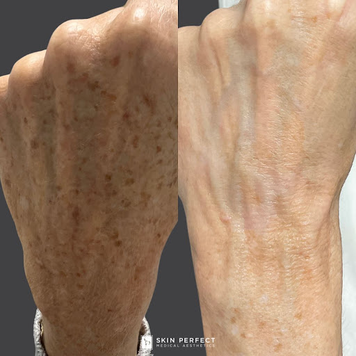 Explore little prince tattoo ideas, creative tattoo ideas in Whittier, available at Skin Perfect Medical Aesthetics