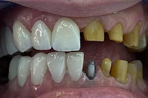 Dr. Anas Fathy Dental Clinic - د. أنس فتحي لعلاج و تجميل الأسنان. الشيخ زايد image