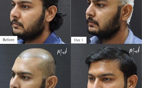 Musk Clinic | Medical Esthetics - Best Hair Transplant in Ahmedabad, Skin, Face, Body & Laser Hair Removal in Ahmedabad image
