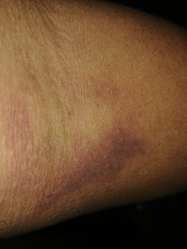 Blood Donation Center «Talecris Plasma Resources», reviews and photos