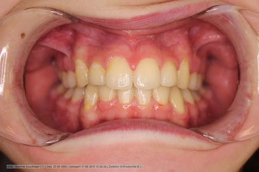 Zwielich Orthodontics